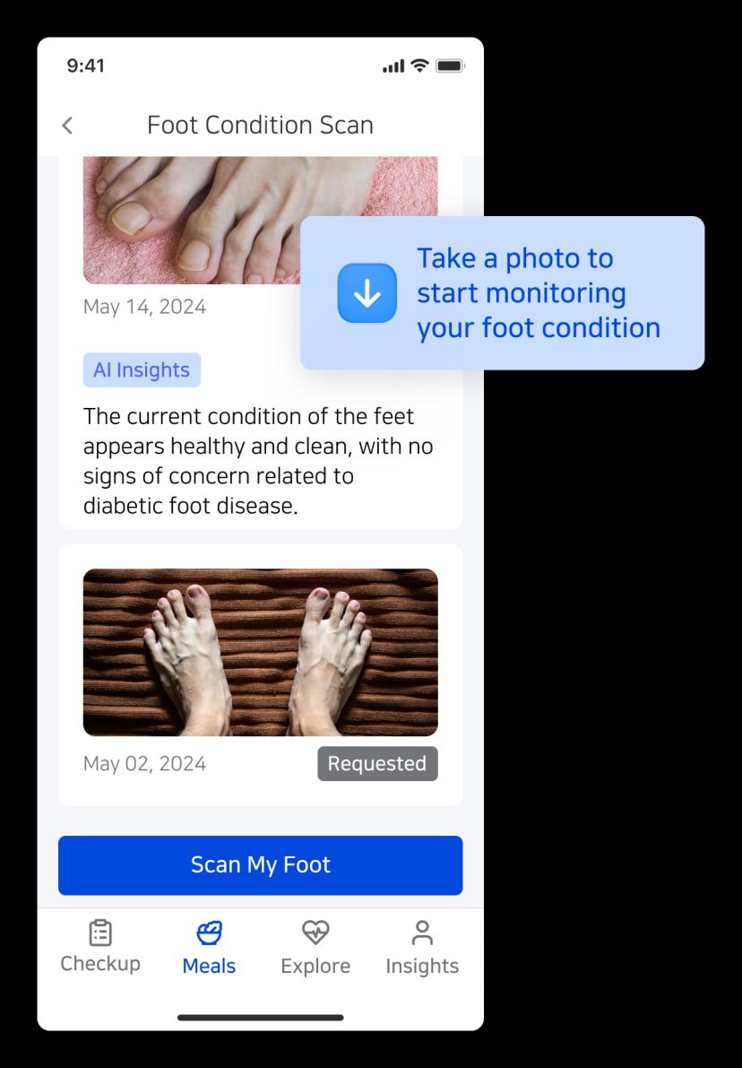 Foot Health Monitoring